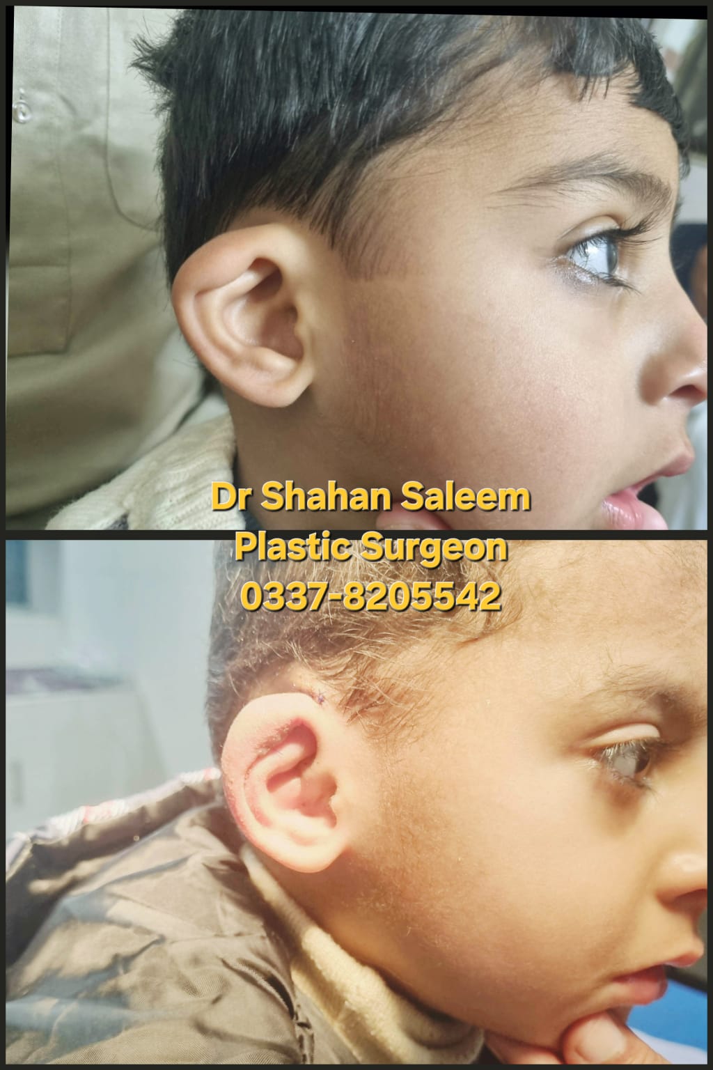 Before & After 53